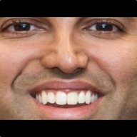 EA'S REATARDED BROTHER